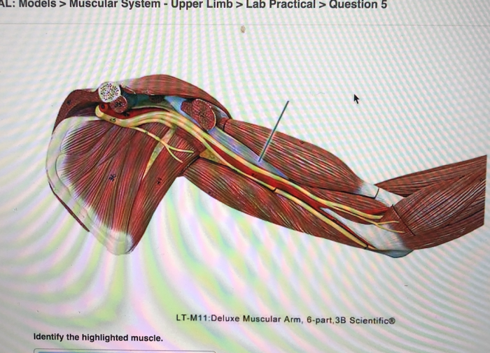 Highlighted solved transcribed m11 muscular extensor longus